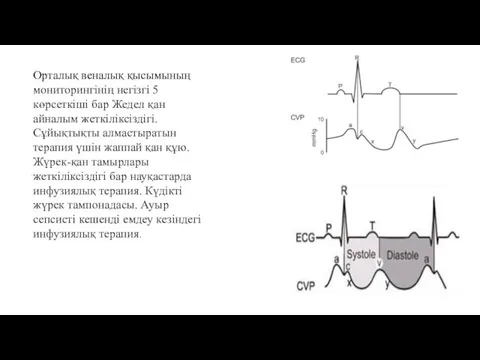 Орталық веналық қысымының мониторингінің негізгі 5 көрсеткіші бар Жедел қан айналым жеткіліксіздігі.