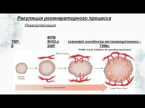 Реваскуляризация ТФР-β тканевой ингибитор металлопротеиназ – ТИМп (TIMP, tissue inhibitor of metalloproteinases)