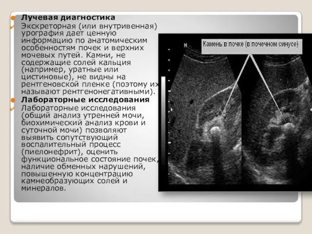 Лучевая диагностика Экскреторная (или внутривенная) урография дает ценную информацию по анатомическим особенностям