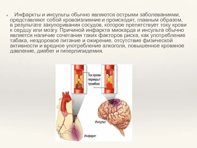 Инфаркты и инсульты обычно являются острыми заболеваниями, представляют собой кровоизлияние и происходят,