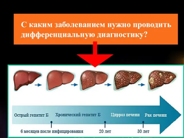 С каким заболеванием нужно проводить дифференциальную диагностику?