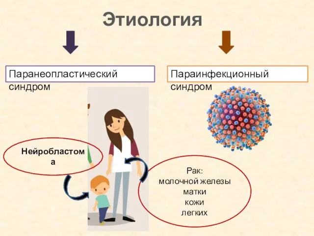 Этиология Паранеопластический синдром Параинфекционный синдром