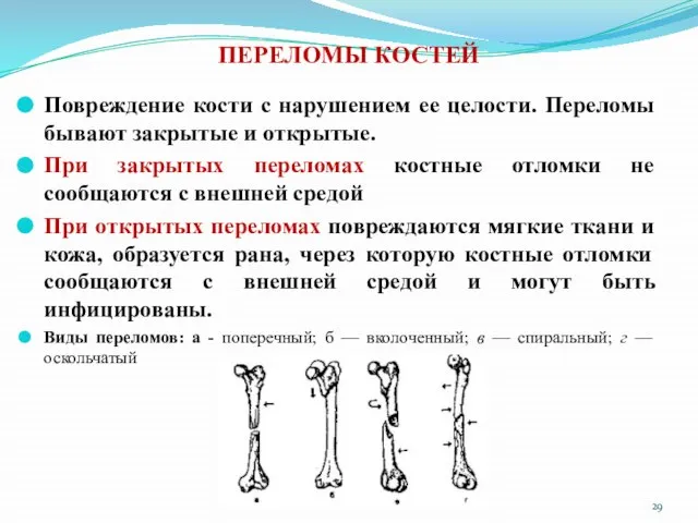 ПЕРЕЛОМЫ КОСТЕЙ Повреждение кости с нарушением ее целости. Переломы бывают закрытые и