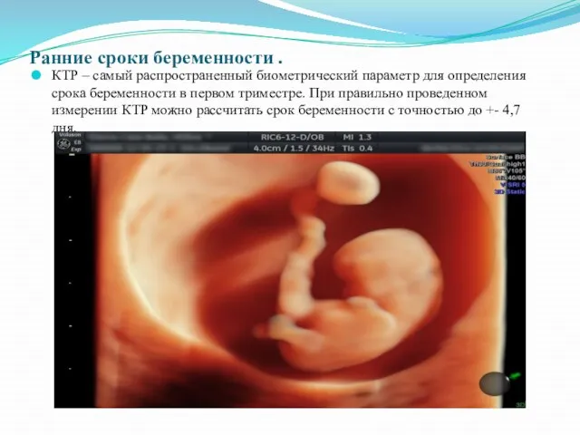 Ранние сроки беременности . КТР – самый распространенный биометрический параметр для определения