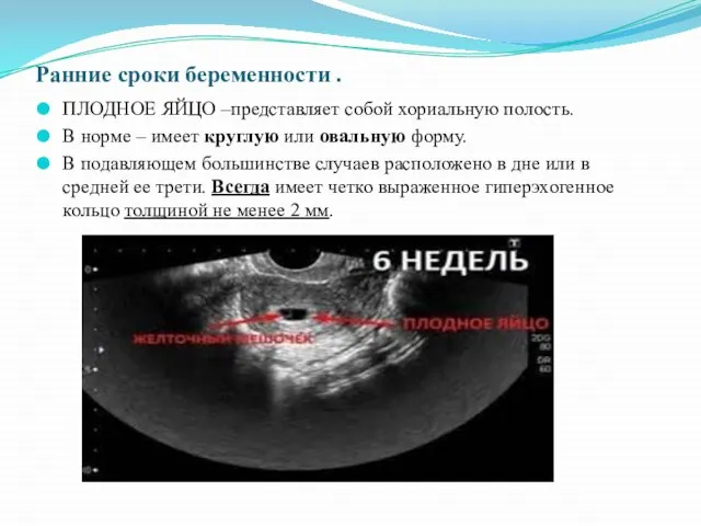 Ранние сроки беременности . ПЛОДНОЕ ЯЙЦО –представляет собой хориальную полость. В норме