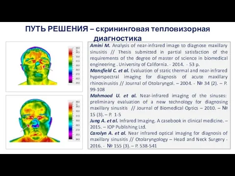Amini M. Analysis of near-infrared image to diagnose maxillary sinusitis // Thesis