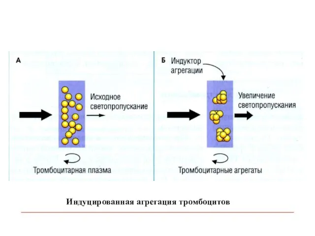 Индуцированная агрегация тромбоцитов