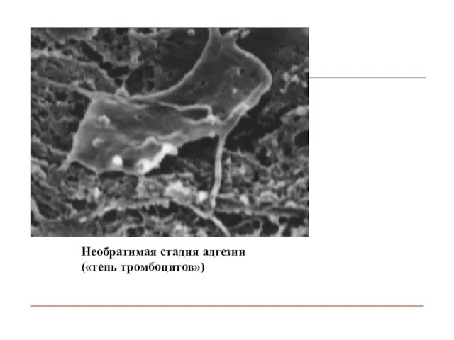 Необратимая стадия адгезии («тень тромбоцитов»)