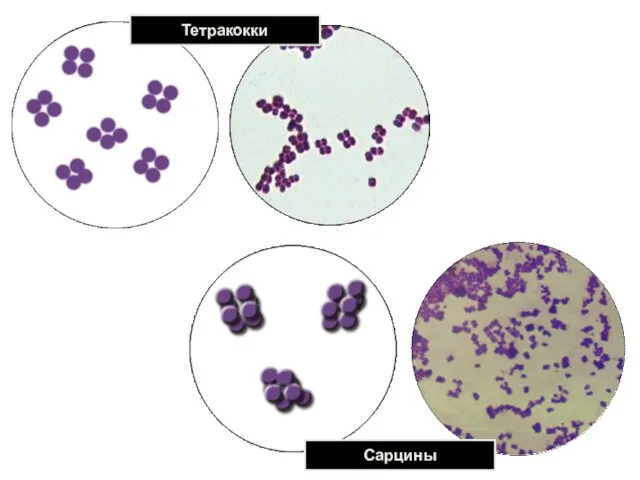 Тетракокки Сарцины