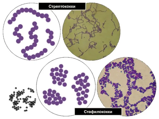 Стрептококки Стафилококки