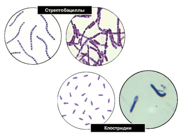 Стрептобациллы Клостридии