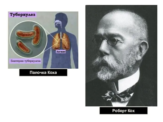 Роберт Кох Палочка Коха