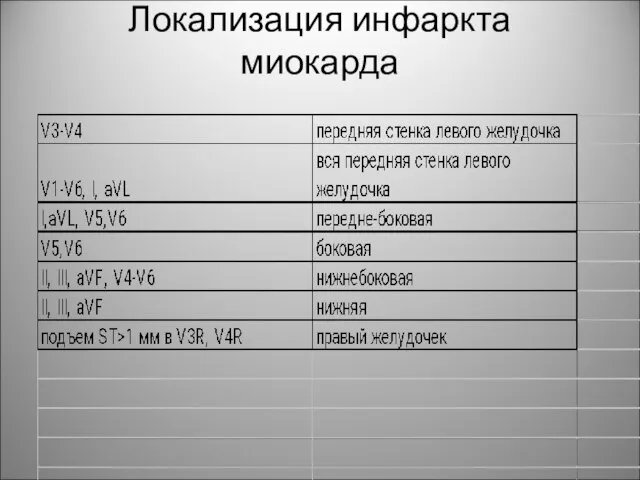 Локализация инфаркта миокарда