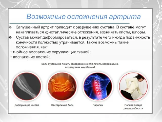 Возможные осложнения артрита Сустав может деформироваться, в результате чего иногда подвижность конечности