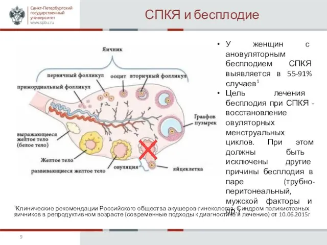 СПКЯ и бесплодие 1Клинические рекомендации Российского общества акушеров-гинекологов: Синдром поликистозных яичников в