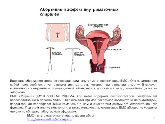 Абортивный эффект внутриматочных спиралей ВМС – внутриматочная спираль делает аборт http://www.aborti.ru/articles/vms Еще