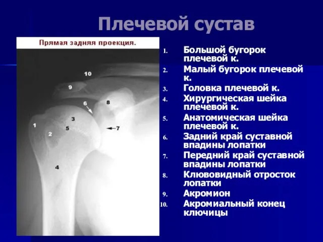 Плечевой сустав Большой бугорок плечевой к. Малый бугорок плечевой к. Головка плечевой