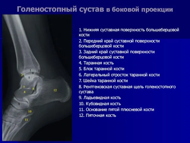 1. Нижняя суставная поверхность большеберцовой кости 2. Передний край суставной поверхности большеберцовой