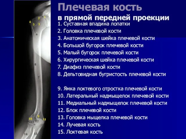 Плечевая кость в прямой передней проекции 1. Суставная впадина лопатки 2. Головка