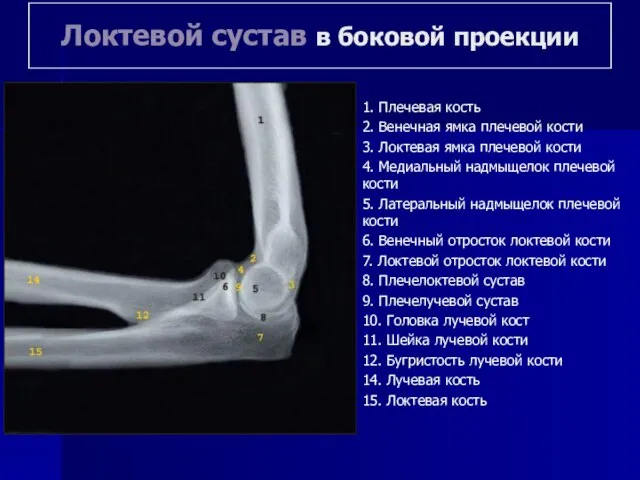 Локтевой сустав в боковой проекции 1. Плечевая кость 2. Венечная ямка плечевой