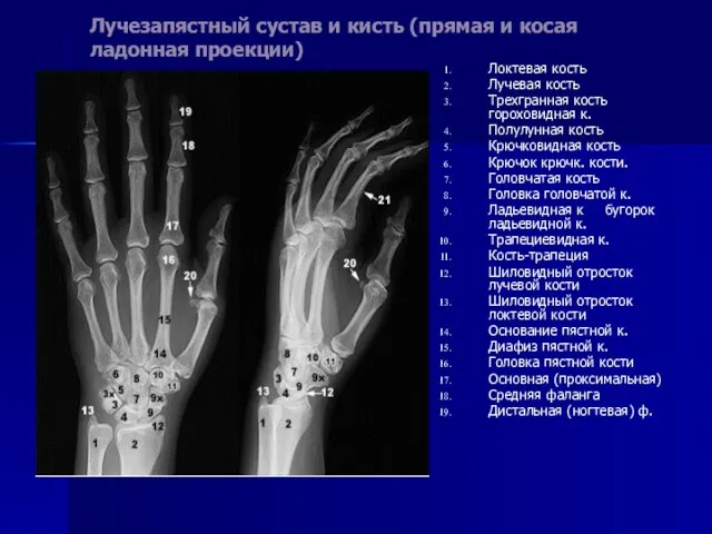 Лучезапястный сустав и кисть (прямая и косая ладонная проекции) Локтевая кость Лучевая