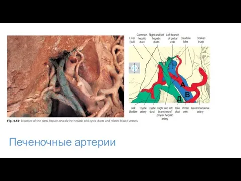 Печеночные артерии Д В А