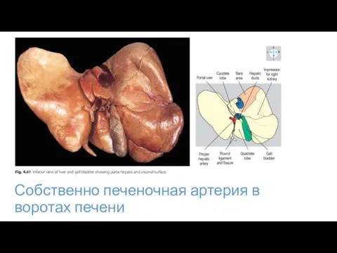 Собственно печеночная артерия в воротах печени