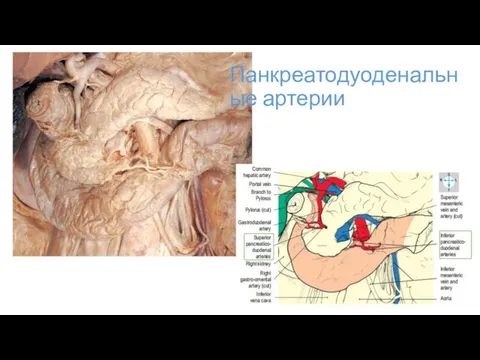 Панкреатодуоденальные артерии