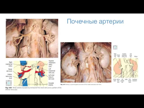 Почечные артерии