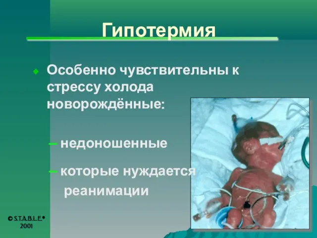 Гипотермия Особенно чувствительны к стрессу холода новорождённые: недоношенные которые нуждается реанимации © S.T.A.B.L.E.® 2001