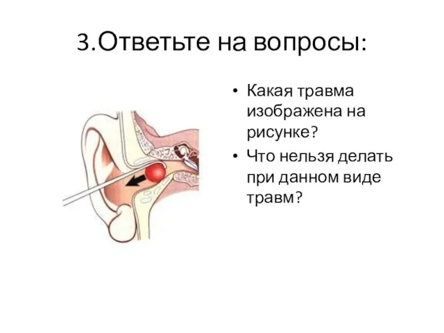 3.Ответьте на вопросы: Какая травма изображена на рисунке? Что нельзя делать при данном виде травм?