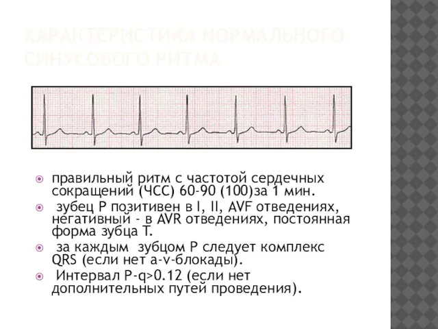 ХАРАКТЕРИСТИКА НОРМАЛЬНОГО СИНУСОВОГО РИТМА правильный ритм с частотой сердечных сокращений (ЧСС) 60-90