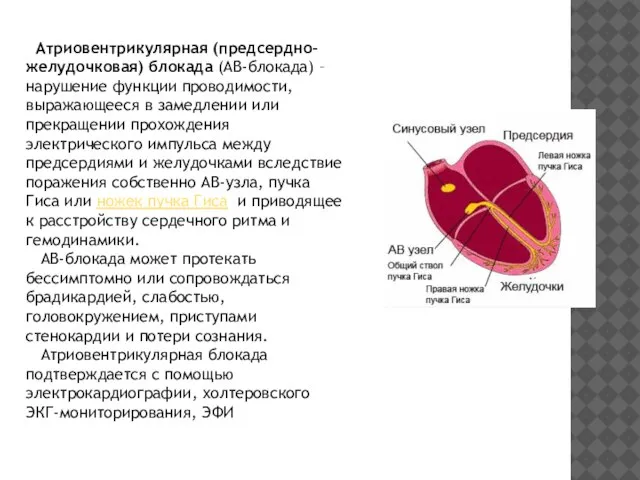 Атриовентрикулярная (предсердно-желудочковая) блокада (АВ-блокада) – нарушение функции проводимости, выражающееся в замедлении или