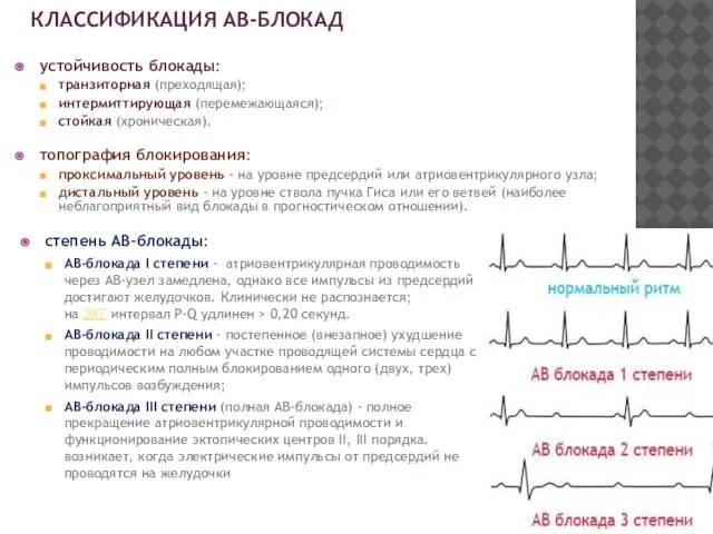 КЛАССИФИКАЦИЯ АВ-БЛОКАД устойчивость блокады: транзиторная (преходящая); интермиттирующая (перемежающаяся); стойкая (хроническая). топография блокирования: