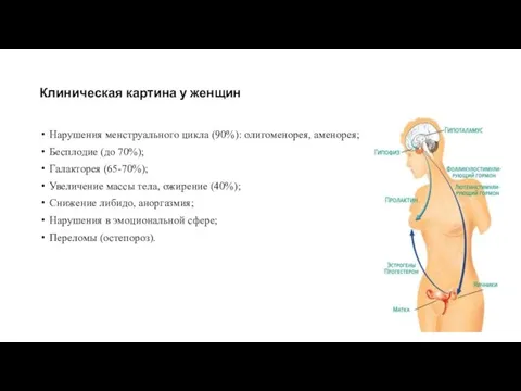 Клиническая картина у женщин Нарушения менструального цикла (90%): олигоменорея, аменорея; Бесплодие (до