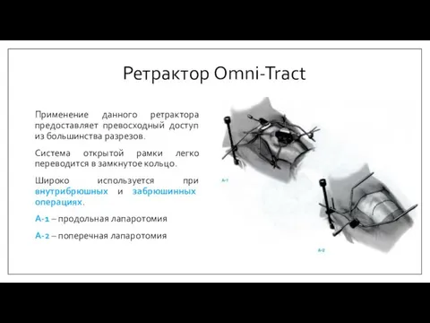 Ретрактор Omni-Tract Применение данного ретрактора предоставляет превосходный доступ из большинства разрезов. Система