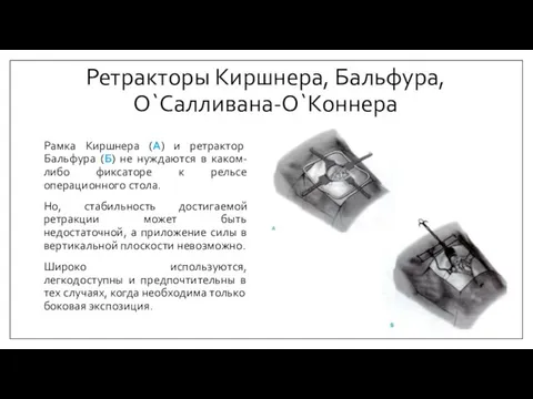 Ретракторы Киршнера, Бальфура, О`Салливана-О`Коннера Рамка Киршнера (А) и ретрактор Бальфура (Б) не