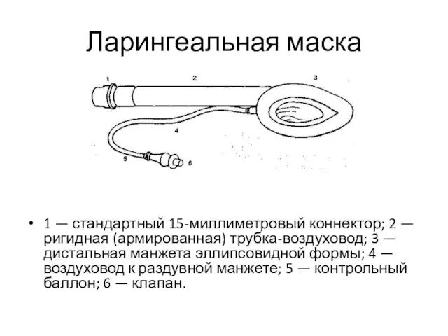 Ларингеальная маска 1 — стандартный 15-миллиметровый коннектор; 2 — ригидная (армированная) трубка-воздуховод;