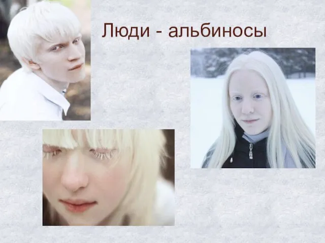 Люди - альбиносы