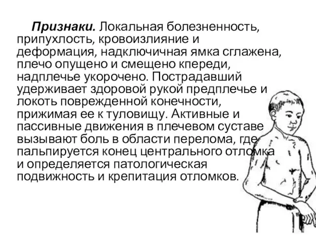 Признаки. Локальная болезненность, припухлость, кровоизлияние и деформация, надключичная ямка сглажена, плечо опущено