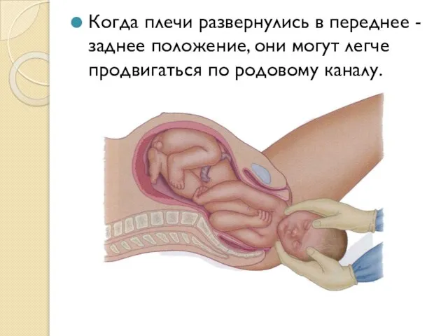 Когда плечи развернулись в переднее -заднее положение, они могут легче продвигаться по родовому каналу.