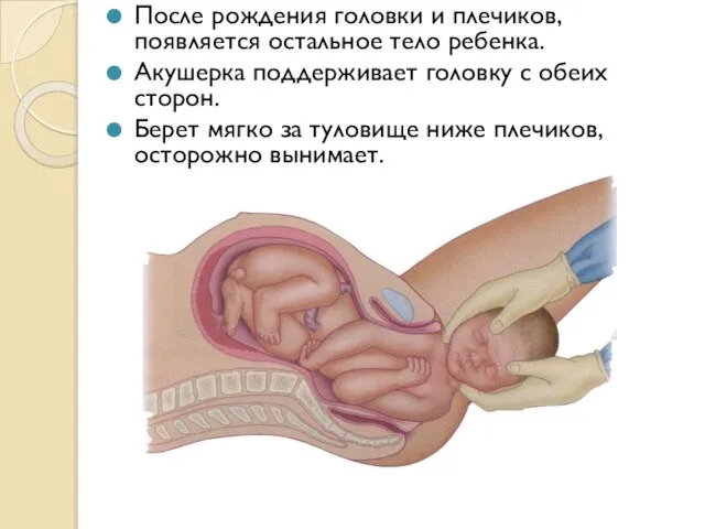 После рождения головки и плечиков, появляется остальное тело ребенка. Акушерка поддерживает головку