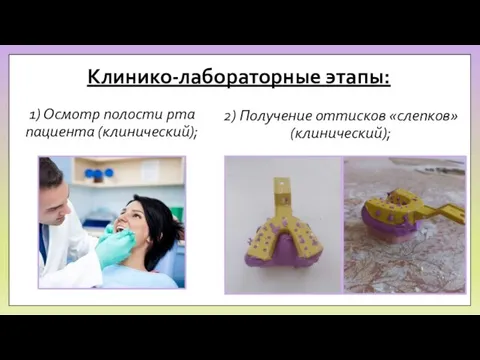 Клинико-лабораторные этапы: 1) Осмотр полости рта пациента (клинический); 2) Получение оттисков «слепков» (клинический);