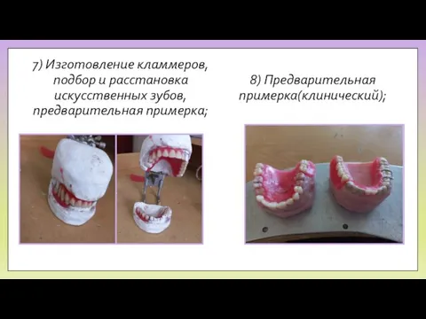 7) Изготовление кламмеров, подбор и расстановка искусственных зубов, предварительная примерка; 8) Предварительная примерка(клинический);