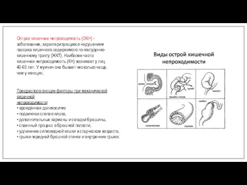 Острая кишечная непроходимость (ОКН) - заболевание, характеризующееся нарушением пассажа кишечного содержимого по