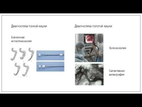 Диагностика тонкой кишки Диагностика толстой кишки Баллонная интестиноскопия Колоноскопия Селективная ангиография