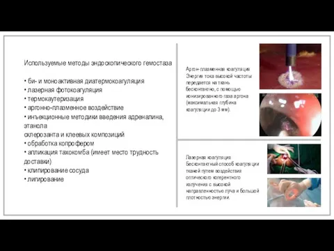 Используемые методы эндоскопического гемостаза • би- и моноактивная диатермокоагуляция • лазерная фотокоагуляция