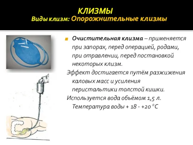 Виды клизм: Опорожнительные клизмы Очистительная клизма – применяется при запорах, перед операцией,