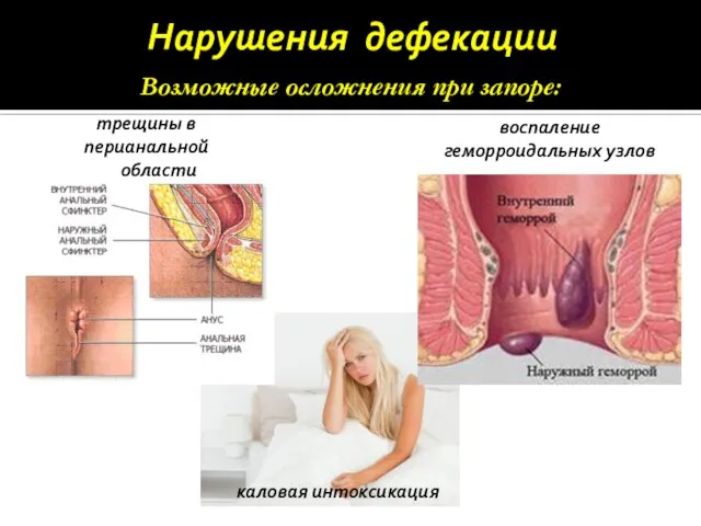 Нарушения дефекации Возможные осложнения при запоре: трещины в перианальной области воспаление геморроидальных узлов каловая интоксикация