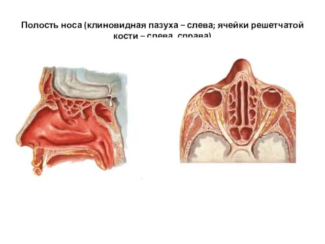 Полость носа (клиновидная пазуха – слева; ячейки решетчатой кости – слева, справа)